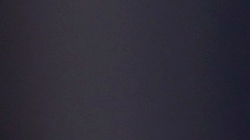 Nuevo contagio de sarampión en refugio para migrantes en Chicago genera alarma ante posible brote