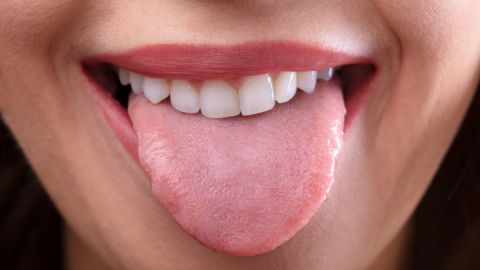 Cómo está su salud según el color de tu lengua