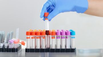 Un nuevo análisis de sangre podría detectar del cáncer colorrectal, según un estudio