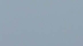 La caída de cabello en los sueños tiene un simbolismo interesante.