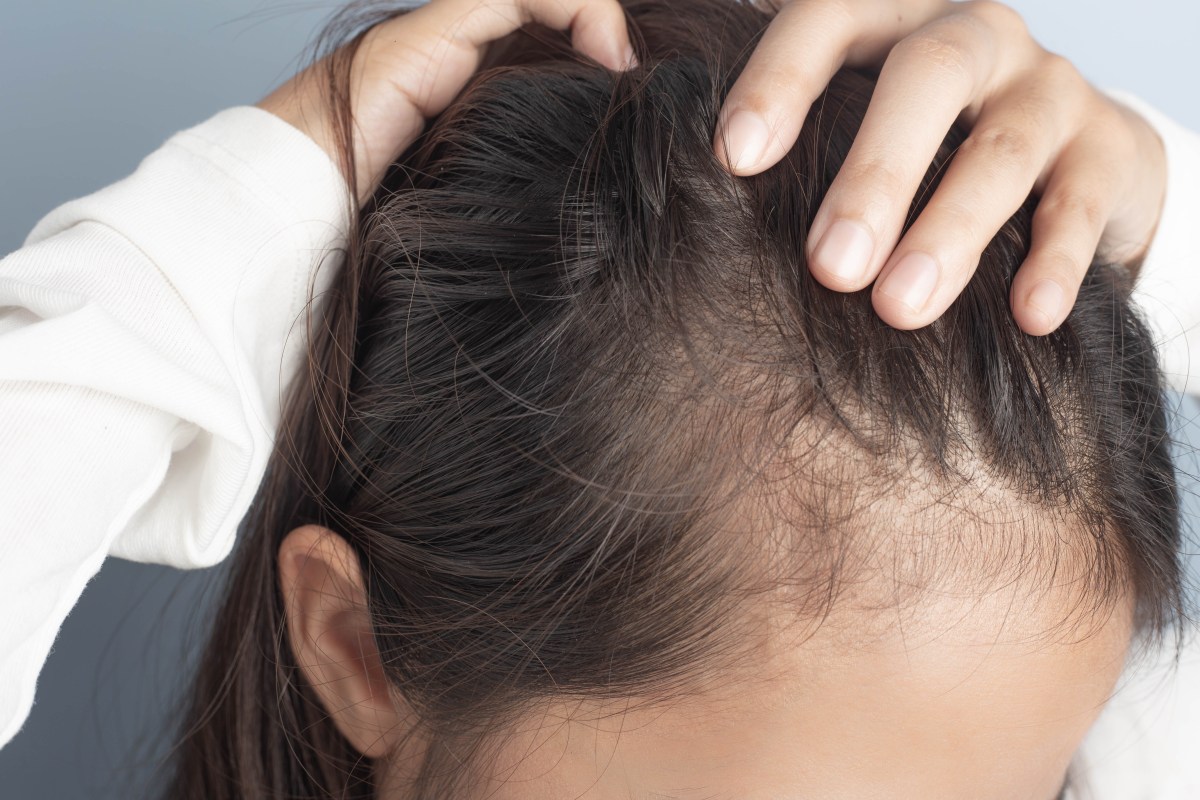 La vitamina perfecta que ayuda en el crecimiento del cabello