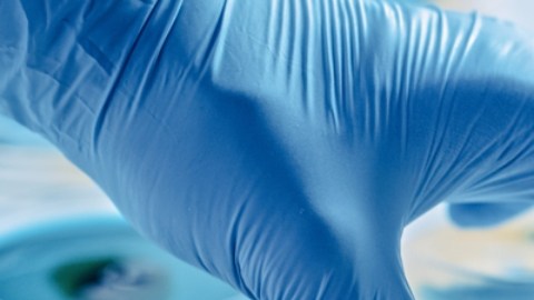 Científicos revelan una nueva forma en la que el ébola se contagia
