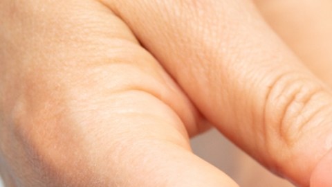 Infecciones por hongos están empeorando en el mundo: qué debes saber