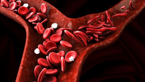 A través de la sangre se podría causar envejecimiento al cerebro y aumentar el riesgo de demencia