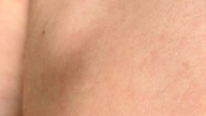 Sarampión en Estados Unidos: qué debes saber