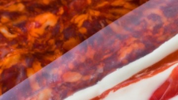 Encuentran gusanos parásitos en el cerebro de un hombre después de que comió tocino poco cocido
