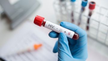 Científicos dicen que pueden eliminar el VIH de las células: de qué se trata el estudio