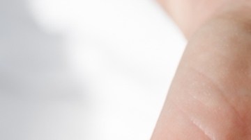 Forense determinó que un hombre murió por toxicidad con vitamina D: de qué se trata