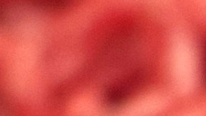 Carne molida potencialmente contaminada con E. coli, advierte el USDA