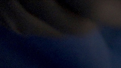 El primer paciente trasplantado con un riñón de cerdo recibe el alta en Boston