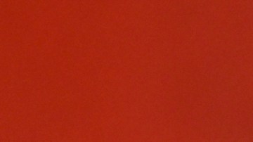 Sofía Vergara mostró cómo luce la cicatriz en su pierna tras su cirugía