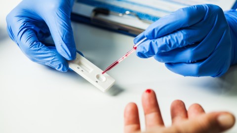 El COVID prolongado deja "huellas" en la sangre, según un nuevo estudio