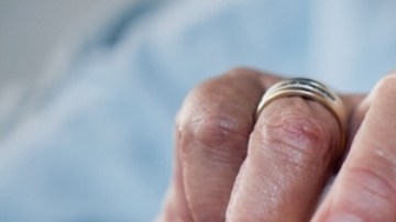 Científicos identifican un vínculo entre el sueño y el riesgo de diabetes tipo 2