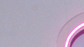 Wendy Guevara fue operada de emergencia por dolor abdominal