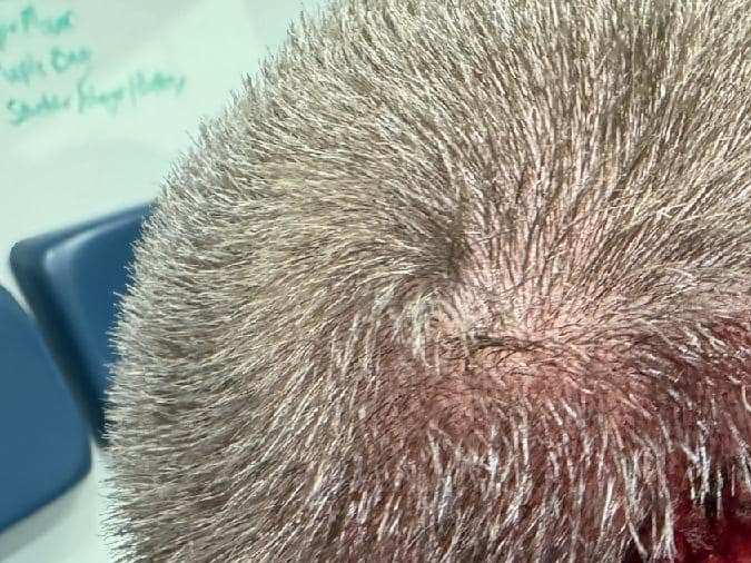 Hombre de Florida le arrancó de una mordida un trozo de cabeza a un oficial durante un festival