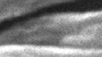 This 2006 electron microscope image provided by the Centers for Disease Control and Prevention shows Mycobacterium tuberculosis bacteria, which causes the disease tuberculosis. The number of U.S. tuberculosis cases in 2023 was the highest in a decade, according to a report released by the CDC on Thursday, March 28, 2024. (Janice Carr/CDC via AP)