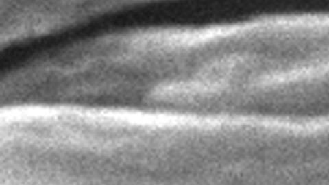 This 2006 electron microscope image provided by the Centers for Disease Control and Prevention shows Mycobacterium tuberculosis bacteria, which causes the disease tuberculosis. The number of U.S. tuberculosis cases in 2023 was the highest in a decade, according to a report released by the CDC on Thursday, March 28, 2024. (Janice Carr/CDC via AP)