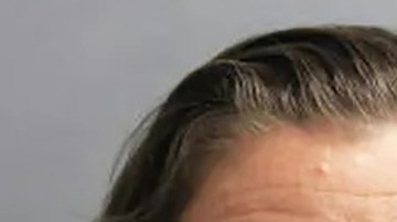 Agnieszka Rydzewski y Anthony Calderon