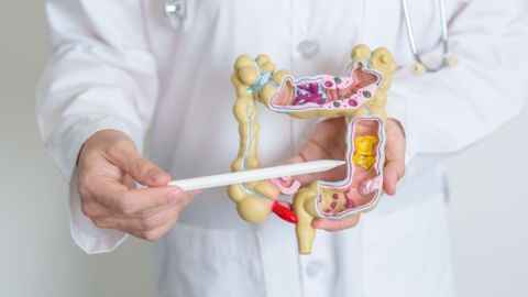 Cáncer de colon se ha duplicado en los jóvenes estadounidenses