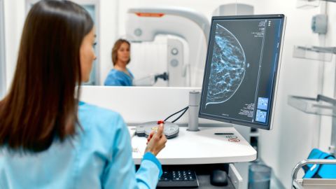 Cuál es la edad correcta para hacerte una mamografía, según médicos expertos de EE.UU.