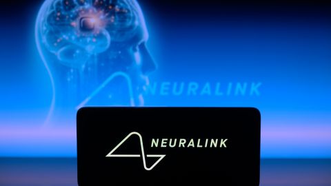 Neuralink