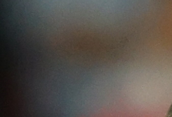 Kylian Mbappé mientras estaba siendo atendido por el cuerpo médico de la Selección de Francia después de fracturarse la nariz durante el encuentro ante Austria.