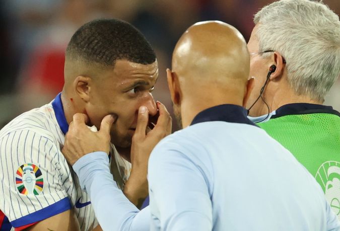 Kylian Mbappé mientras estaba siendo atendido por el cuerpo médico de la Selección de Francia después de fracturarse la nariz durante el encuentro ante Austria.