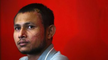 Shah Alam (Malaysia), 13/06/2024.- Malaysian footballer Faisal Halim reacts during a press conference while still suffering from injuries, in Shah Alam, outside Kuala Lumpur, Malaysia, 13 June 2024. Faisal Halim suffered fourth-degree burns after he was splashed with acid by an unidentified assailant at a shopping centre on 05 May. 'I really miss football and want to play and practice. I have to focus on recovery and rehabilitation. I will wait for the doctor to give the permission to play', Faisal said during the press conference. (Malasia) EFE/EPA/FAZRY ISMAIL
