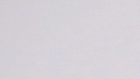 Kourtney Kardashian mostró la cicatriz de la cirugía fetal que salvó la vida de su bebé