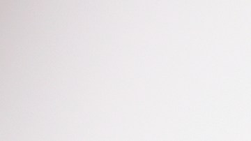 Kevin Jonas reveló que se sometió a una cirugía por cáncer de piel