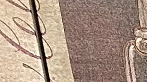 Gloria R. gracias a MediCal ha podido enfrentar el cáncer de la piel.