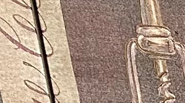 Gloria R. gracias a MediCal ha podido enfrentar el cáncer de la piel.