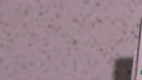 Zepbound de Eli Lilly podría ser la mejor solución para las personas con apnea del sueño