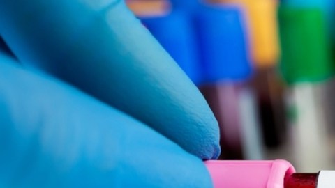 Gripe aviar en EE.UU.: CDC tienen 1 millón de pruebas, pero aún no actúan "rápido según expertos"