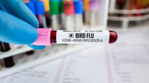 Gripe aviar en EE.UU.: CDC tienen 1 millón de pruebas, pero aún no actúan "rápido según expertos"
