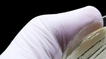 Descubren el primer caso de una rara infección sexual en New York: de qué se trata