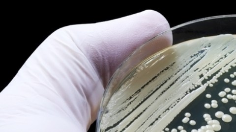 Descubren el primer caso de una rara infección sexual en New York: de qué se trata