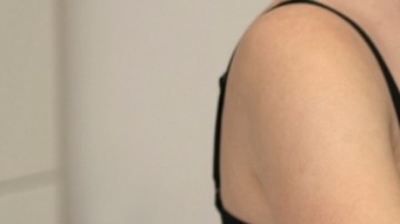 Casos de melanoma se han incrementado en Estados Unidos: qué debemos saber