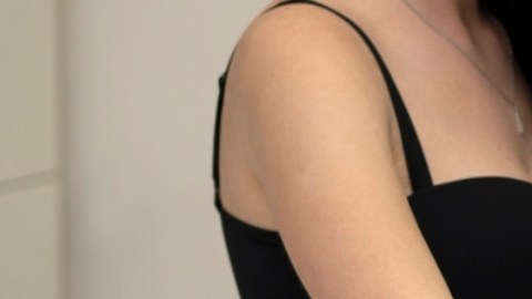 Casos de melanoma se han incrementado en Estados Unidos: qué debemos saber