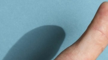 OMS pide medidas urgentes para tratar la mpox en el mundo