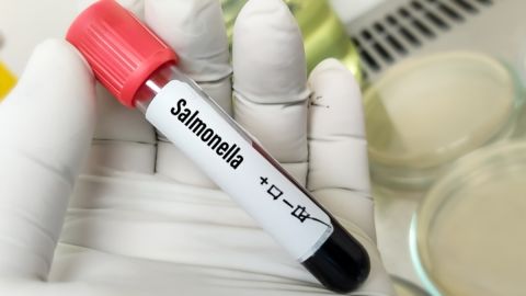 CDC advierten sobre brote de salmonella en 9 estados del país