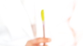 Filadelfia es el estado con las tasas más altas de ITS en Estados Unidos