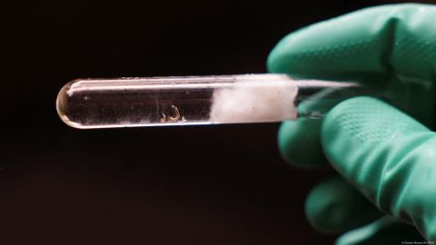 El Ministerio de Salud de Brasil dijo que los síntomas de la enfermedad son similares a los del dengue