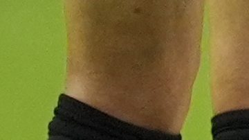 Messi se torció el tobillo en la final de la Copa América.