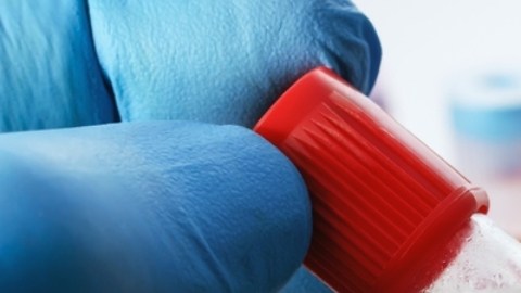 Análisis de sangre podría diagnosticar pérdida de memoria