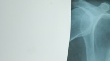 El virus del Covid-19 permanece hasta dos años en el cuerpo según radiografías