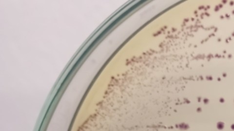 Una fallecido por brote de E. coli en el condado de Flathead