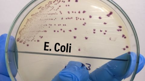Una fallecido por brote de E. coli en el condado de Flathead