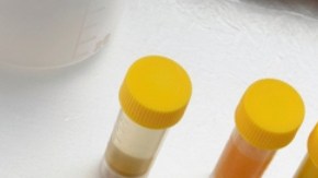 La gripe aviar puede mutar, según un nuevo estudio