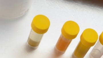 La gripe aviar puede mutar, según un nuevo estudio